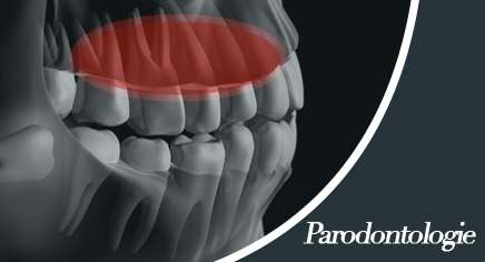 parodontologie pontarlier
